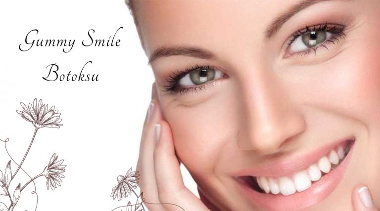 gummy smile botoksu